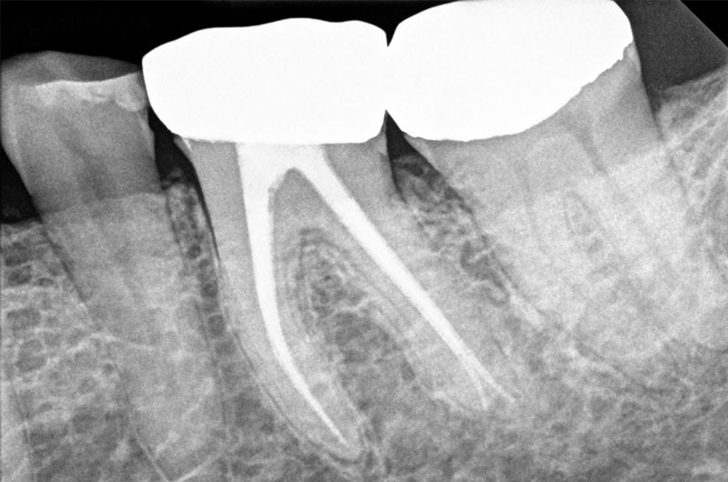 Endodonzia